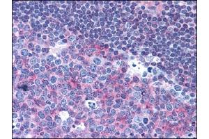 Immunohistochemistry (IHC) image for anti-CD40 (CD40) antibody (ABIN400699) (CD40 Antikörper)