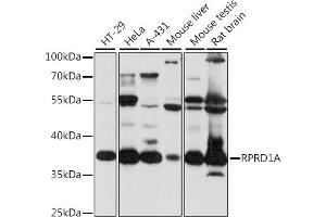 Western blot analysis of extracts of various cell lines, using RPRD1A antibody (ABIN7269895) at 1:1000 dilution. (RPRD1A Antikörper  (AA 47-276))