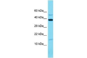 Western Blotting (WB) image for anti-Mitochondrial Ribosomal Protein L14 (MRPL14) (C-Term) antibody (ABIN2791154) (MRPL14 Antikörper  (C-Term))