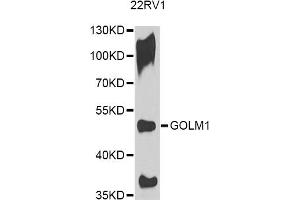 Western blot analysis of extracts of 22RV1 cells, using GOLM1 antibody. (GOLM1 Antikörper)