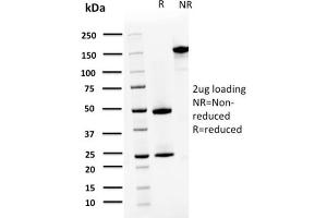SDS-PAGE Analysis Purified S100A4 Mouse Monoclonal Antibody (CPTC-S100A4-3).
