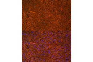 Immunofluorescence analysis of mouse liver cells using PAH Rabbit mAb (ABIN7269264) at dilution of 1:25 (40x lens). (Phenylalanine Hydroxylase Antikörper)