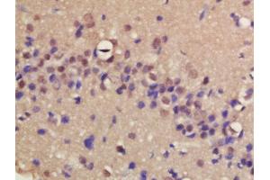 Formalin-fixed and paraffin embedded rat brain labeled with Rabbit Anti-ERCC8/CSA Polyclonal Antibody, Unconjugated (ABIN1713778) at 1:200 followed by conjugation to the secondary antibody and DAB staining (ERCC8 Antikörper  (AA 161-260))