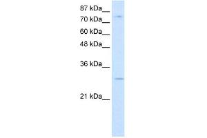 WB Suggested Anti-RBM28 Antibody Titration:  0. (RBM28 Antikörper  (C-Term))