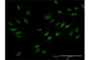 Immunofluorescence of purified MaxPab antibody to ZCCHC9 on HeLa cell. (ZCCHC9 Antikörper  (AA 1-271))