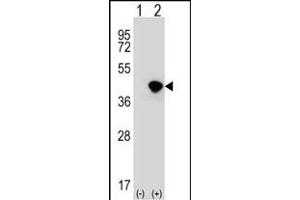 Western blot analysis of DFFA (arrow) using rabbit polyclonal DFFA Antibody (C-term) (ABIN653234 and ABIN2842766). (DFFA Antikörper  (C-Term))