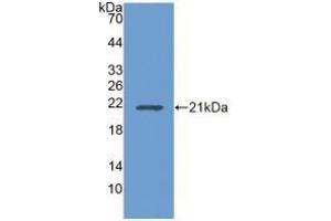 Detection of Recombinant UBE2L3, Human using Polyclonal Antibody to Ubiquitin Conjugating Enzyme E2L3 (UBE2L3) (UBE2L3 Antikörper  (AA 4-154))