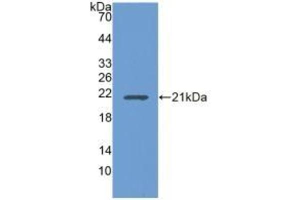 UBE2L3 Antikörper  (AA 4-154)