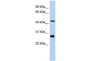 SYT9 antibody used at 1 ug/ml to detect target protein. (SYT9 Antikörper  (Middle Region))