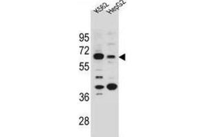 Western Blotting (WB) image for anti-Na+/H+ Exchanger Domain Containing 1 (NHEDC1) antibody (ABIN2996071) (NHEDC1 Antikörper)