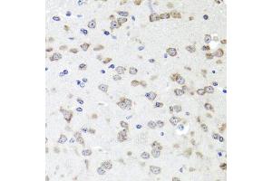 Immunohistochemistry of paraffin-embedded mouse brain using IGFBP5 antibody (ABIN6130485, ABIN6142257, ABIN6142259 and ABIN6216084) at dilution of 1:100 (40x lens). (IGFBP5 Antikörper  (AA 68-167))