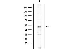 anti-Minichromosome Maintenance Deficient 9 (MCM9) (C-Term) antibody