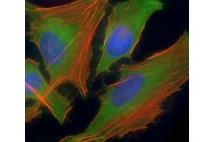 Immunofluorescent staining of permeabilized human HeLa cells with ASS1 antibody at 1:25 dilution, followed by Dylight 488-conjugated goat anti-rabbit lgG (green). (ASS1 Antikörper  (AA 192-221))