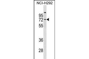 COL9A3 Antibody (Center) (ABIN1881221 and ABIN2838976) western blot analysis in NCI- cell line lysates (35 μg/lane). (COL9A3 Antikörper  (AA 501-528))