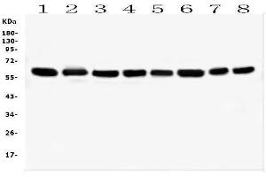 Western blot analysis of HSPD1 using anti-HSPD1 antibody (ABIN7600976).