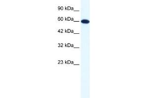 WB Suggested Anti-DDX6 Antibody Titration:  1. (DDX6 Antikörper  (N-Term))
