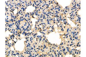 ABIN6257158 and ABIN6275985 at 1/100 staining Rat spleen tissue by IHC-P.