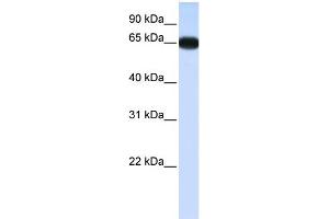 WB Suggested Anti-DLX4 Antibody Titration:  0. (DLX4 Antikörper  (N-Term))