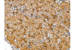 ABIN7094439 and ABIN7098487 at 1/100 staining Mouse brain tissue by IHC-P.