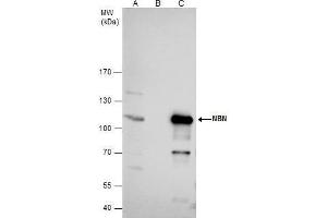 IP Image NBS1 antibody immunoprecipitates nibrin protein in IP experiments. (Nibrin Antikörper)