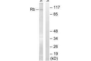 Western blot analysis of extracts from Jurkat cells, treated with PMA (125 ng/mL, 30 mins), using Retinoblastoma (Ab-608) antibody. (Retinoblastoma 1 Antikörper  (Ser608))