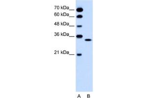 Western Blotting (WB) image for anti-Olfactory Receptor, Family 5, Subfamily T, Member 2 (OR5T2) antibody (ABIN2462482) (OR5T2 Antikörper)