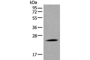 Western blot analysis of Human liver tissue lysate using APOD Polyclonal Antibody at dilution of 1:550 (Apolipoprotein D Antikörper)