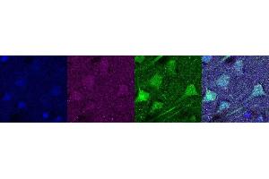 Immunohistochemistry (IHC) image for anti-Ubiquitin Carboxyl-terminal Esterase L1 (Ubiquitin Thiolesterase) (UCHL1) antibody (ABIN7456167) (UCHL1 Antikörper)