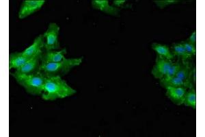 Immunofluorescent analysis of Hela cells using ABIN7154436 at dilution of 1:100 and Alexa Fluor 488-congugated AffiniPure Goat Anti-Rabbit IgG(H+L) (GAB2 Antikörper  (AA 273-484))