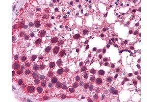 Human Testis; Testis; KLF9 Antibody - N-terminal region in Human Testis cells using Immunohistochemistry (KLF9 Antikörper  (N-Term))