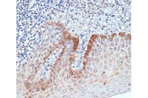 Immunohistochemistry of paraffin-embedded Human tonsil using CXCL12 Polyclonal Antibody at dilution of 1:100 (40x lens). (CXCL12 Antikörper)
