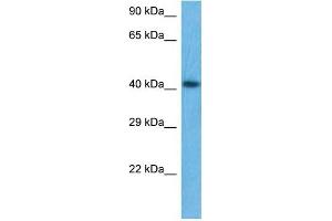 WB Suggested Anti-IKZF5 antibody Titration: 1 ug/mL Sample Type: Human THP-1 Whole Cell (IKZF5 Antikörper  (Middle Region))