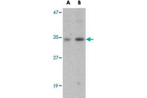 Western blot analysis of GNPDA1 in mouse kidney tissue lysate with GNPDA1 polyclonal antibody  at (A) 1 and (B) 2 ug/mL . (GNPDA1 Antikörper  (C-Term))