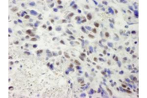Immunohistochemistry (IHC) image for anti-hSET1 (AA 1200-1250) antibody (ABIN7448601) (hSET1 (AA 1200-1250) Antikörper)