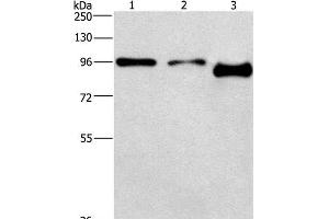 Western Blot analysis of A431 and hela cell,Mouse brain tissue using PIP5K1C Polyclonal Antibody at dilution of 1:500 (PIP5K1C Antikörper)