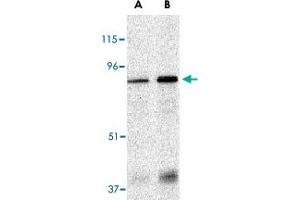 Western blot analysis of EIF2AK2 in Caco-2 whole cell lysate with EIF2AK2 polyclonal antibody  at (A) 1 and (B) 2 ug/mL . (EIF2AK2 Antikörper  (N-Term))