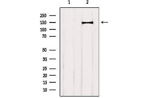 Western blot analysis of extracts from Mouse brain, using CNTNAP4 Antibody.