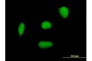 Immunofluorescence of purified MaxPab antibody to ELAC2 on HepG2 cell. (ELAC2 Antikörper  (AA 1-826))