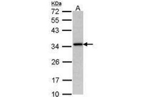 Image no. 1 for anti-N-Acetyltransferase 1 (Arylamine N-Acetyltransferase) (NAT1) (AA 1-157) antibody (ABIN467615) (NAT1 Antikörper  (AA 1-157))