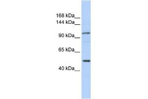 WB Suggested Anti-KIAA1618 Antibody Titration:  0. (RNF213 Antikörper  (N-Term))