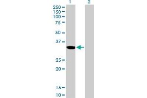 Western Blot analysis of ZNF215 expression in transfected 293T cell line by ZNF215 MaxPab polyclonal antibody. (ZNF215 Antikörper  (AA 1-304))