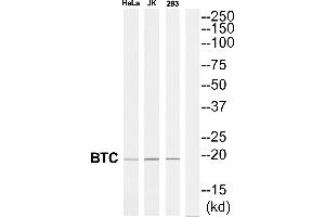 Western blot analysis of extracts from 293/Jurkat/HeLa cells, using BTC antibody. (Betacellulin Antikörper  (Internal Region))