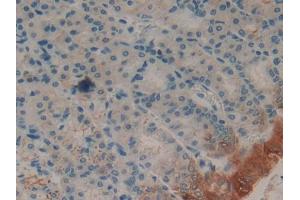 Used in DAB staining on fromalin fixed paraffin- embedded spleen tissue (FABP2 Antikörper  (AA 2-132))