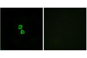Immunofluorescence analysis of MCF-7 cells, using CKLF1 antibody. (CMTM1 Antikörper  (C-Term))
