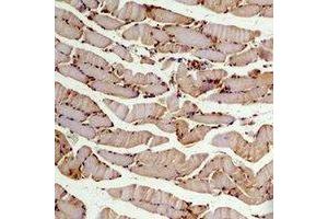 Immunohistochemical analysis of Beta2A-tubulin staining in mouse skeletal muscle formalin fixed paraffin embedded tissue section.