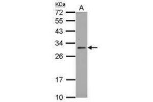 Image no. 1 for anti-TP53 induced glycolysis regulatory phosphatase (TIGAR) (AA 1-270) antibody (ABIN1497017) (TIGAR Antikörper  (AA 1-270))