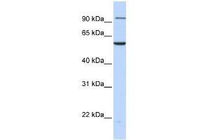 Transportin 2 antibody used at 1 ug/ml to detect target protein. (TNPO2 Antikörper)
