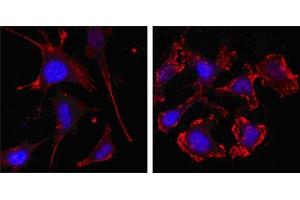 Confocal immunofluorescence analysis of SKBR-3 (left) and A549 (right) cells using beta Actin mouse mAb (red, the secondary Ab is Cy3-Goat anti mouse IgG). (beta Actin Antikörper  (N-Term))