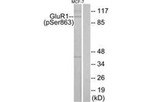 Western blot analysis of extracts from MCF-7 cells, using GluR1 (Phospho-Ser863) Antibody. (Glutamate Receptor 1 Antikörper  (pSer863))