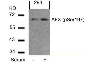 Western blot analysis of extracts from 293 cells untreated or treated with serum using AFX(Phospho-Ser197) Antibody. (FOXO4 Antikörper  (pSer197))